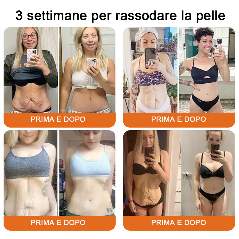 🥇Crema completa al veleno d'api 🔥 ULTIMO GIORNO 80% di sconto🔥