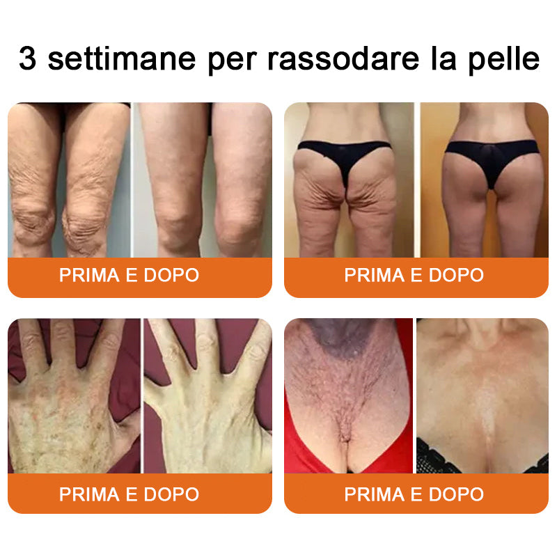 🥇Crema completa al veleno d'api 🔥 ULTIMO GIORNO 80% di sconto🔥
