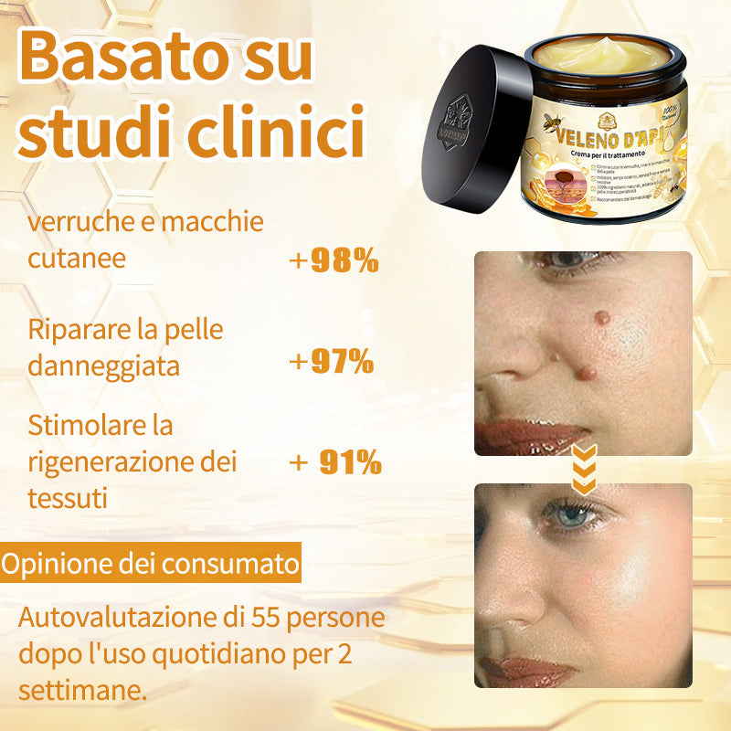 BigeBee™ 🌿Crema per il trattamento della pelle al veleno d'api