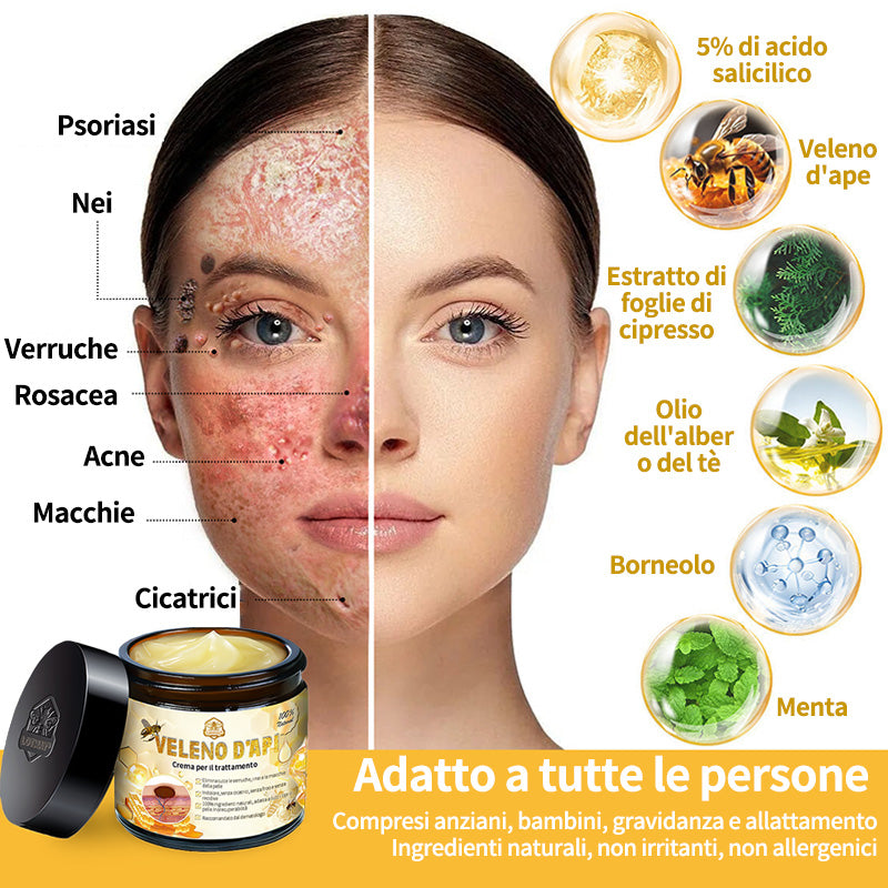 BigeBee™ 🌿Crema per il trattamento della pelle al veleno d'api