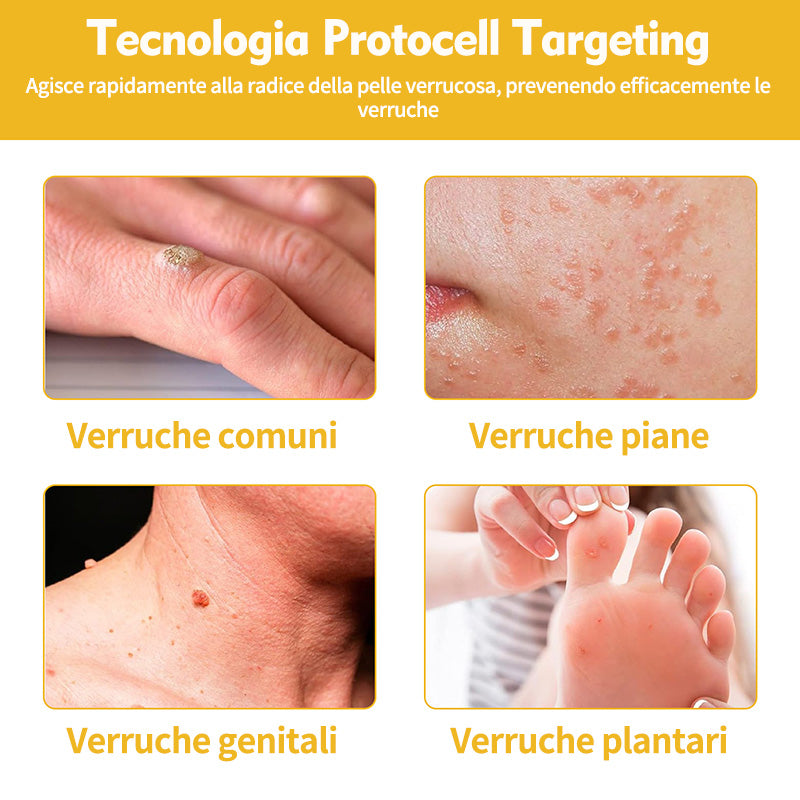 BigeBee™ 🌿Crema per il trattamento della pelle al veleno d'api