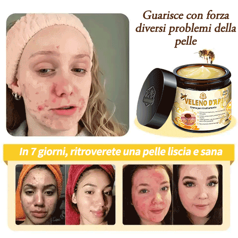 BigeBee™ 🌿Crema per il trattamento della pelle al veleno d'api