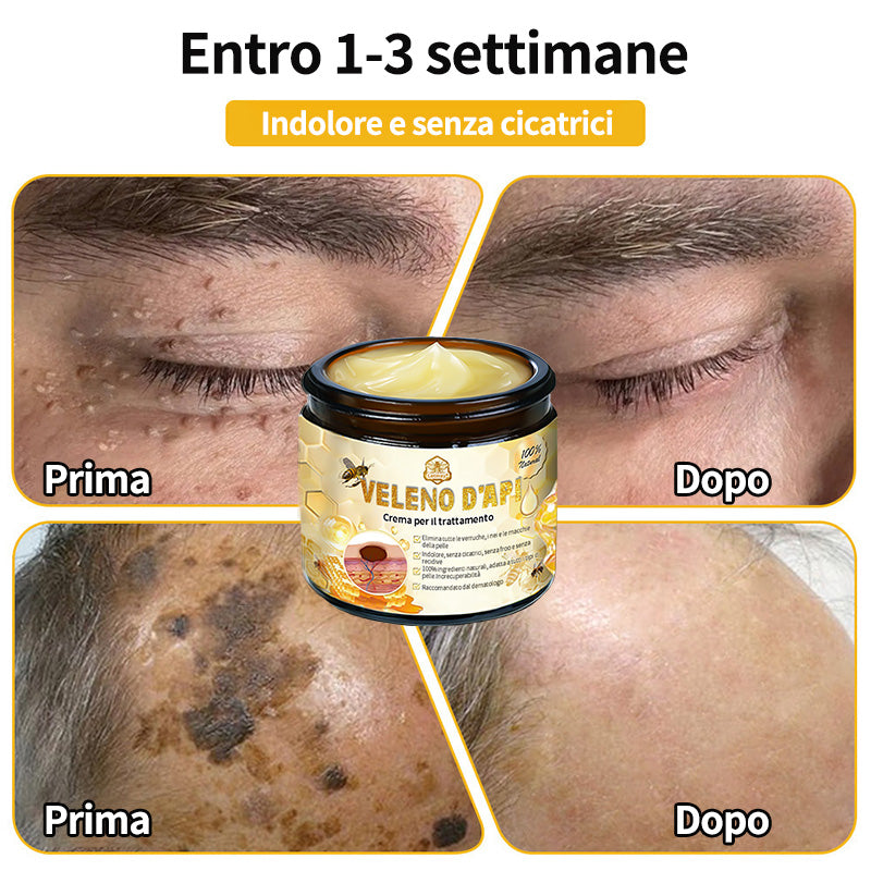 BigeBee™ 🌿Crema per il trattamento della pelle al veleno d'api