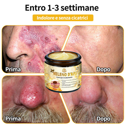 BigeBee™ Crema per il trattamento della pelle al veleno d'api