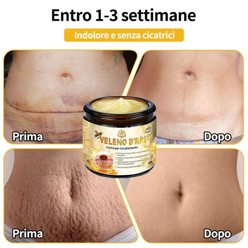 BigeBee™ Crema per il trattamento della pelle al veleno d'api