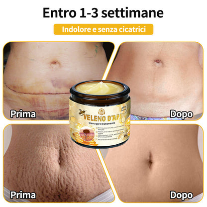 BigeBee™ Crema per il trattamento della pelle al veleno d'api