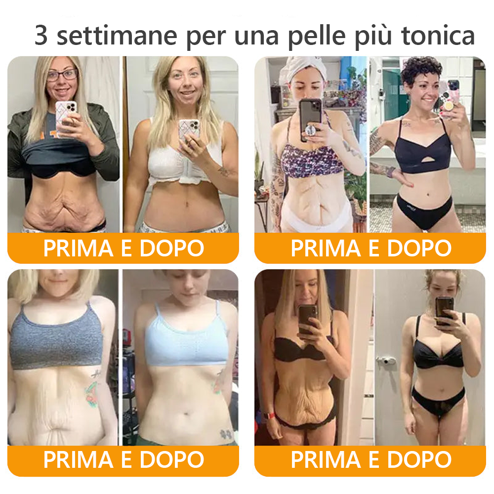 Prodotto e spedito dall'Italia✅ Crema completa al veleno d'api 🔥ULTIMO GIORNO 80% DI SCONTO🔥
