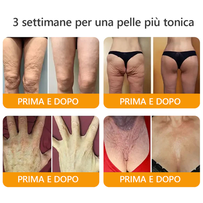 Prodotto e spedito dall'Italia✅ Crema completa al veleno d'api 🔥ULTIMO GIORNO 80% DI SCONTO🔥
