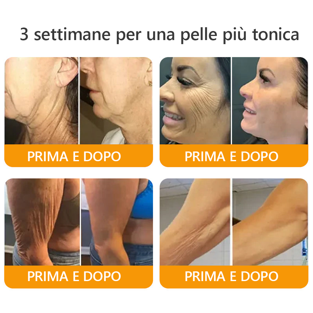 Prodotto e spedito dall'Italia✅ Crema completa al veleno d'api 🔥ULTIMO GIORNO 80% DI SCONTO🔥