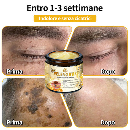 BigeBee™ Crema per il trattamento della pelle al veleno d'api